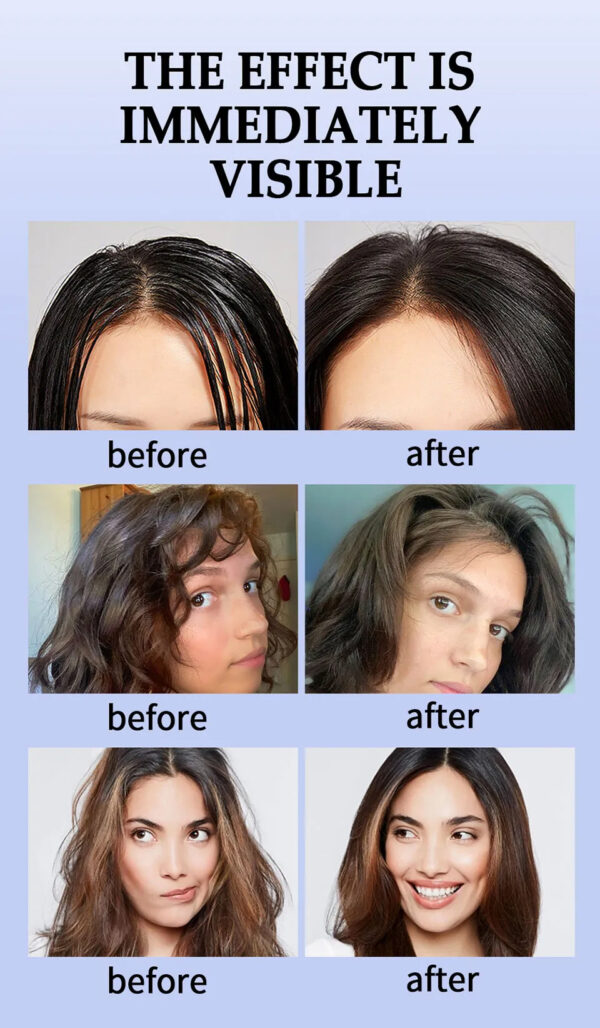 8 SEVICH New Hair Volume Powder For Women Fluffy Increase Hair