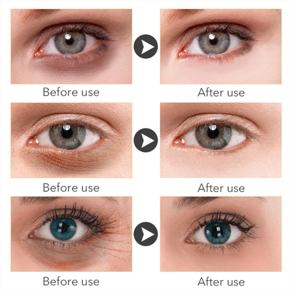 S80a049cc907f4f6fba62301581a0210cx Best Collagen Anti-Wrinkle Eye Cream Removal Puffiness Dark Circle