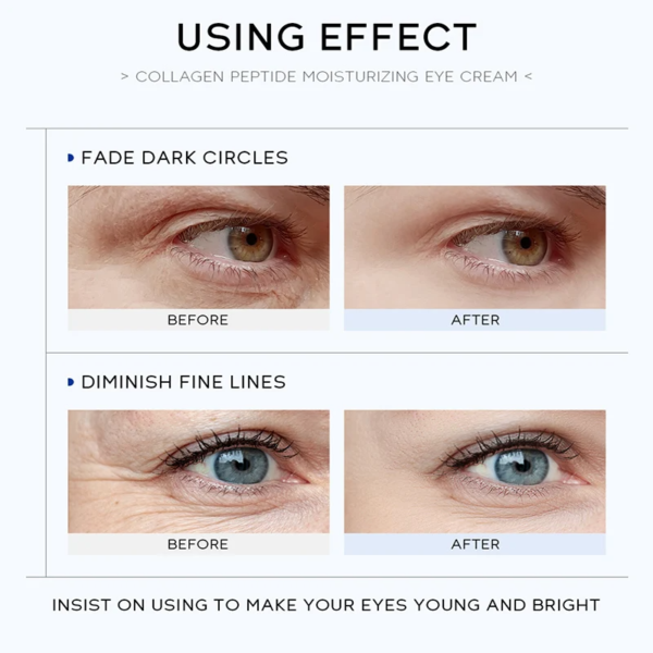 Sdc9b08ce249148ecb84f391c265e7b8fu Best Collagen Anti-Wrinkle Eye Cream Removal Puffiness Dark Circle